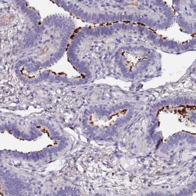 Immunohistochemistry-Paraffin: C3orf80 Antibody [NBP2-48872]