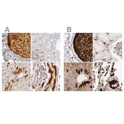 Immunohistochemistry-Paraffin: C4 binding protein A Antibody [NBP1-88262]