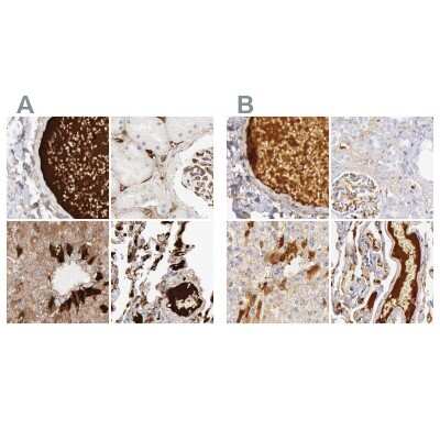 Immunohistochemistry-Paraffin: C4 binding protein A Antibody [NBP1-88263]