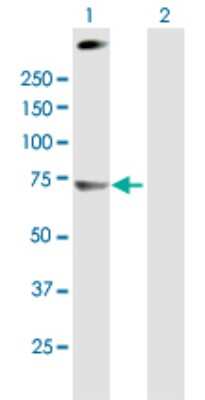 Western Blot: C4 binding protein A Antibody [H00000722-B01P]