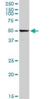 Western Blot: C4 binding protein A Antibody [H00000722-D01P]