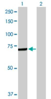 Western Blot: C4 binding protein A Antibody [H00000722-D01P]