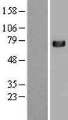 Western Blot: C4 binding protein A Overexpression Lysate [NBL1-08458]