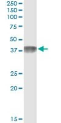 Immunoprecipitation: C4 binding protein B Antibody (1G9) [H00000725-M01]