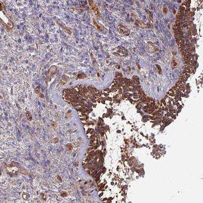 Immunohistochemistry-Paraffin: C4 binding protein B Antibody [NBP2-14412]