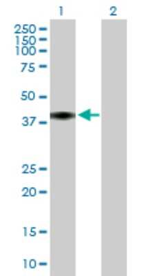 Western Blot: C4 binding protein B Antibody [H00000725-B01P]