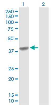 Western Blot: C4 binding protein B Antibody [H00000725-D01P]