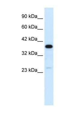 Western Blot: C4 binding protein B Antibody [NBP1-58983]