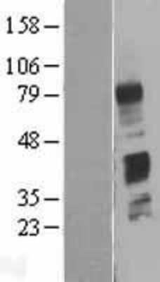 Western Blot: C4 binding protein B Overexpression Lysate [NBP2-10690]