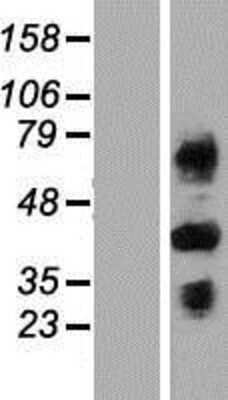 Western Blot: C4 binding protein B Overexpression Lysate [NBP2-11242]