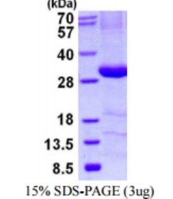 SDS-PAGE: Recombinant Human C4 binding protein B His Protein [NBP1-98876]