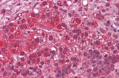 Immunohistochemistry-Paraffin: C4.4A/LYPD3 Antibody [NBP3-14553]