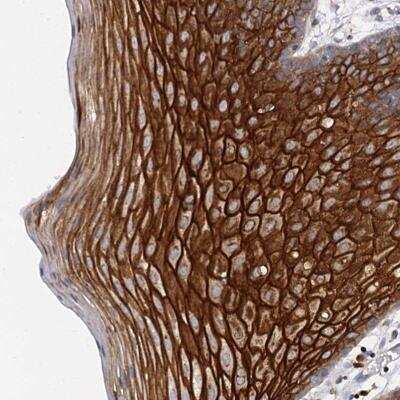 Immunohistochemistry: C4.4A/LYPD3 Antibody [NBP2-32598]