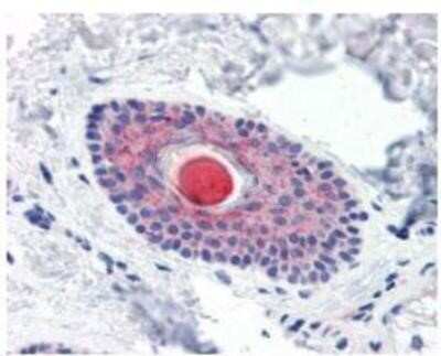Immunohistochemistry-Paraffin: C4.4A/LYPD3 Antibody - BSA Free [NBP1-44371]