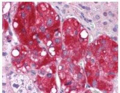 Immunohistochemistry-Paraffin: C4.4A/LYPD3 Antibody - BSA Free [NBP1-44371]