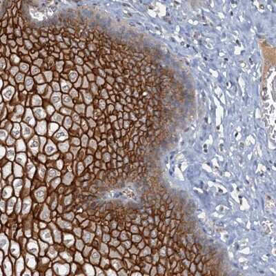 Immunohistochemistry-Paraffin: C4.4A/LYPD3 Antibody [NBP2-32598]