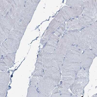 Immunohistochemistry-Paraffin: C4.4A/LYPD3 Antibody [NBP2-32598]
