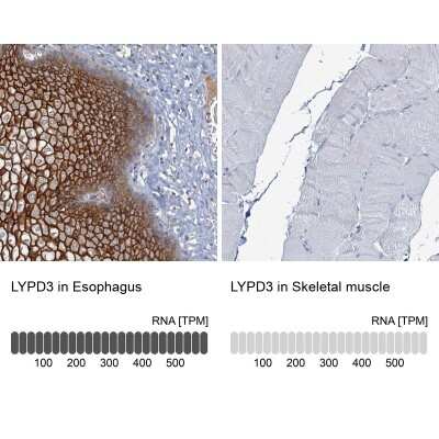 Immunohistochemistry-Paraffin: C4.4A/LYPD3 Antibody [NBP2-32598]