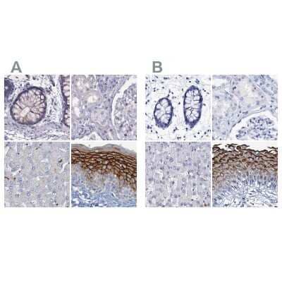 Immunohistochemistry-Paraffin: C4.4A/LYPD3 Antibody [NBP2-32598]