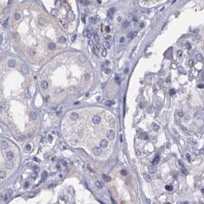 Immunohistochemistry-Paraffin: C4.4A/LYPD3 Antibody [NBP2-32598]