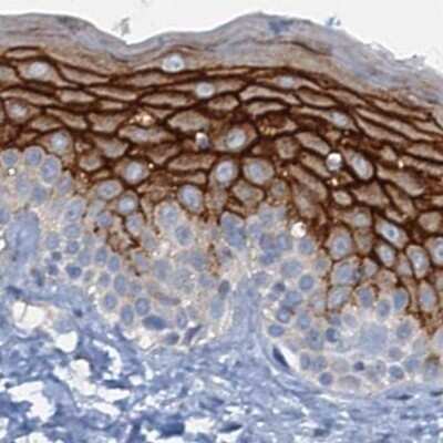 Immunohistochemistry-Paraffin: C4.4A/LYPD3 Antibody [NBP2-32598]