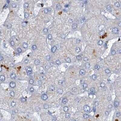 Immunohistochemistry-Paraffin: C4.4A/LYPD3 Antibody [NBP2-32598]