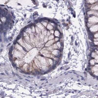 Immunohistochemistry-Paraffin: C4.4A/LYPD3 Antibody [NBP2-32598]