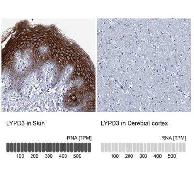 Immunohistochemistry-Paraffin: C4.4A/LYPD3 Antibody [NBP2-32605]