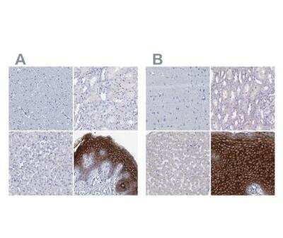 Immunohistochemistry-Paraffin: C4.4A/LYPD3 Antibody [NBP2-32605]