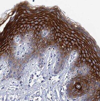 Immunohistochemistry-Paraffin: C4.4A/LYPD3 Antibody [NBP2-32605]