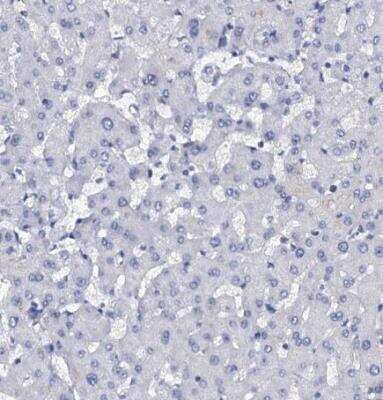 Immunohistochemistry-Paraffin: C4.4A/LYPD3 Antibody [NBP2-32605]
