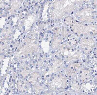 Immunohistochemistry-Paraffin: C4.4A/LYPD3 Antibody [NBP2-32605]