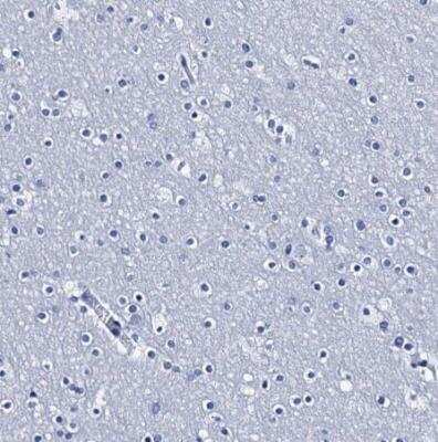 Immunohistochemistry-Paraffin: C4.4A/LYPD3 Antibody [NBP2-32605]