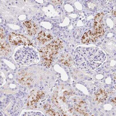 Immunohistochemistry-Paraffin: C4orf17 Antibody [NBP2-31819]