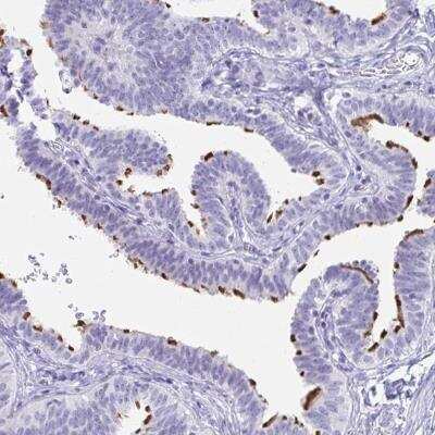 Immunohistochemistry-Paraffin: C4orf17 Antibody [NBP2-31831]