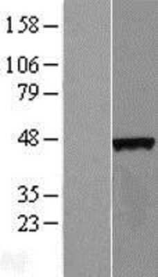 Western Blot: C4orf17 Overexpression Lysate [NBL1-08463]