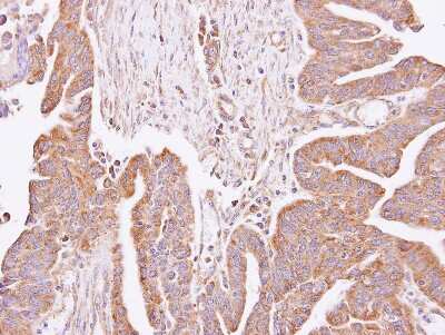 Immunohistochemistry-Paraffin: C4orf19 Antibody [NBP1-32492]
