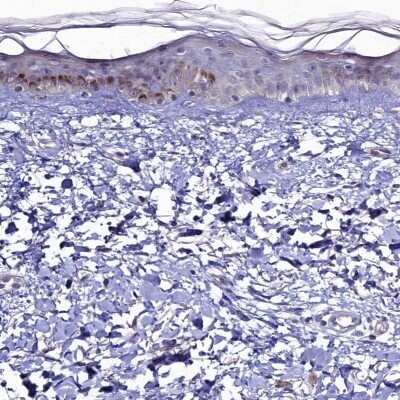 Immunohistochemistry-Paraffin: C4orf19 Antibody [NBP1-91734]