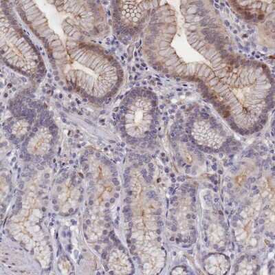 Immunohistochemistry-Paraffin: C4orf19 Antibody [NBP1-91734]