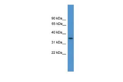 Western Blot: C4orf19 Antibody [NBP2-87103]