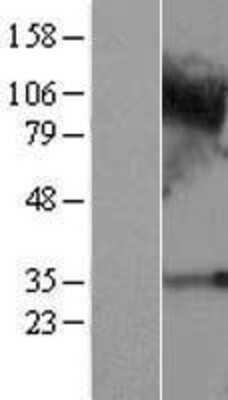 Western Blot: C4orf19 Overexpression Lysate [NBL1-08465]