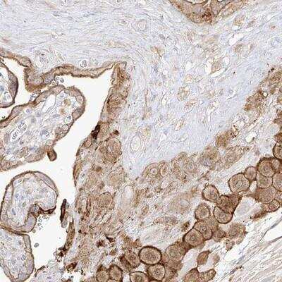 Immunohistochemistry-Paraffin: ZGRF1 Antibody [NBP1-83750]