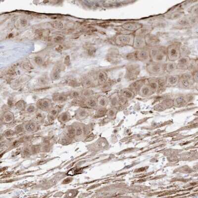 Immunohistochemistry-Paraffin: ZGRF1 Antibody [NBP2-48596]