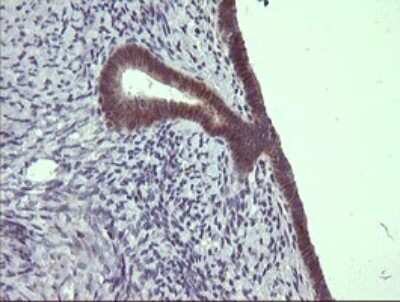 Immunohistochemistry: CFAP299 Antibody (OTI1A6) [NBP2-45584]