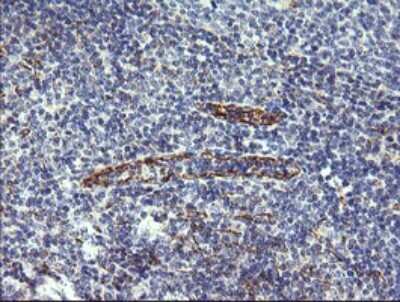 Immunohistochemistry: CFAP299 Antibody (OTI1A6) [NBP2-45584]