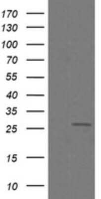 Western Blot: CFAP299 Antibody (OTI1A6) [NBP2-45584]