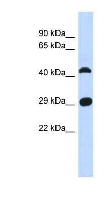 Western Blot: CFAP299 Antibody [NBP1-56792]