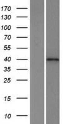 Western Blot: HPF1 Overexpression Lysate [NBP2-06907]