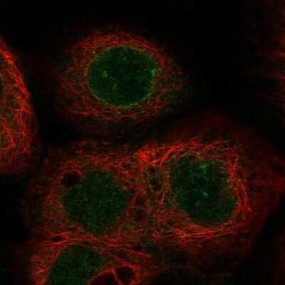 Immunocytochemistry/ Immunofluorescence: ABHD18 Antibody [NBP2-30812]