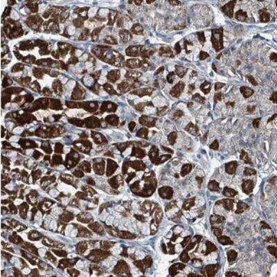 Immunohistochemistry: ABHD18 Antibody [NBP2-30812]